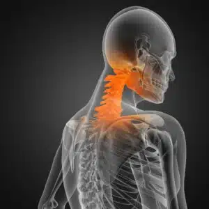 neck injury at work