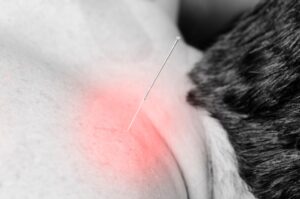 A black and white image of a needle in someone's back.